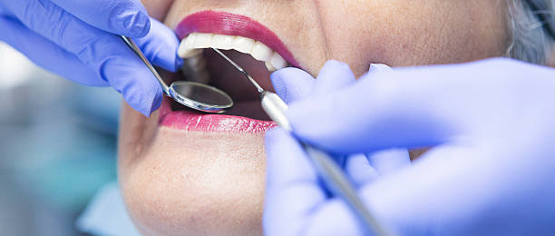 Best Emergency Treatment for Dental Infections or Abscesses in Fort Deposit, AL
